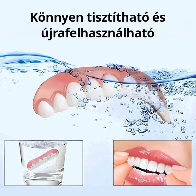 Tökéletes Mosoly Fogpótlás Készlet